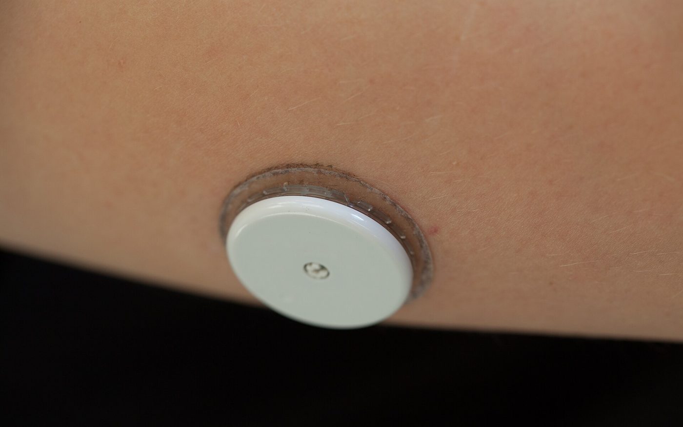 Small round sensor worn on a patient’s upper arm